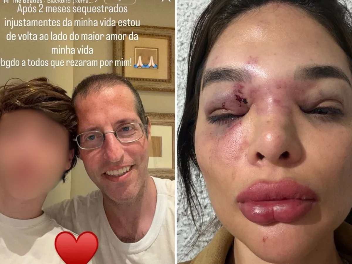 Ivo Kos usou arma de choque e taco de baisebol para agredir esposa, diz MP