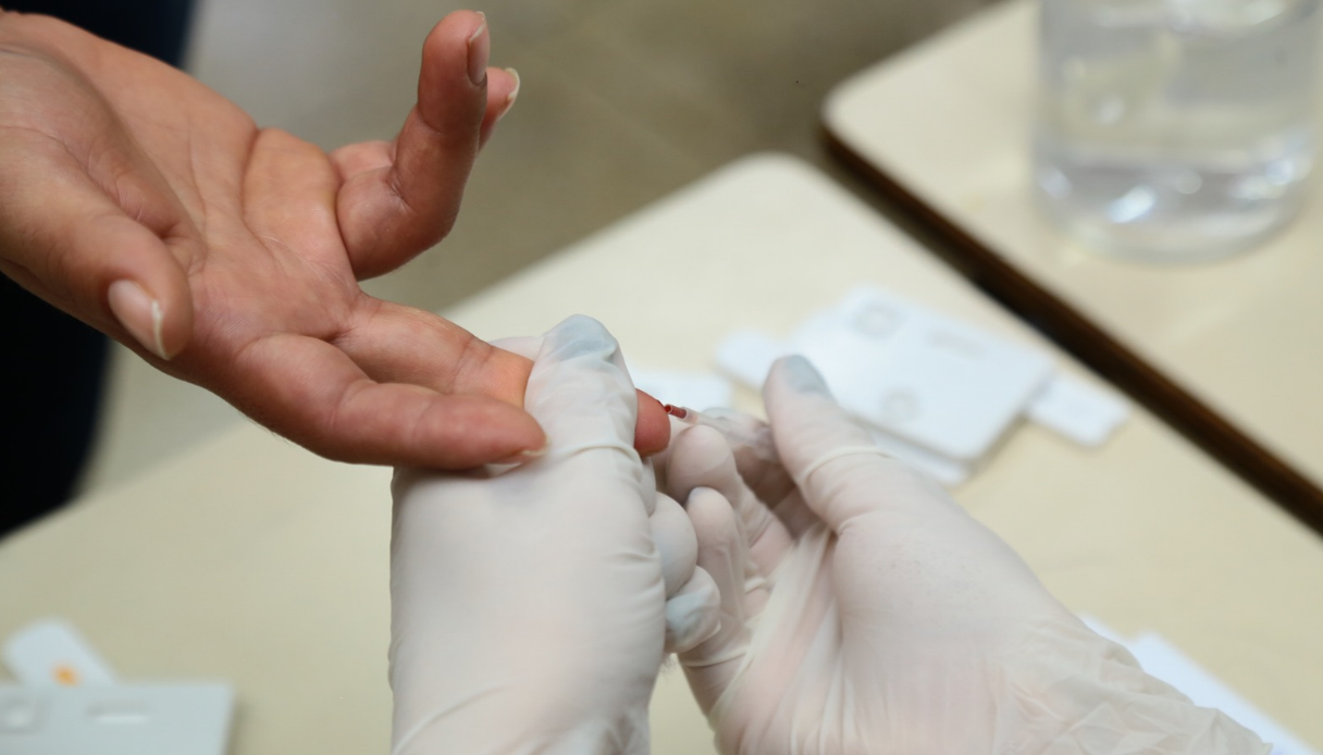 MPF abre procedimento para acompanhar aumento de casos de HIV no Brasil