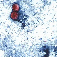 Brote de cyclospora por lechuga en EU expone la caída de inspecciones de la FDA