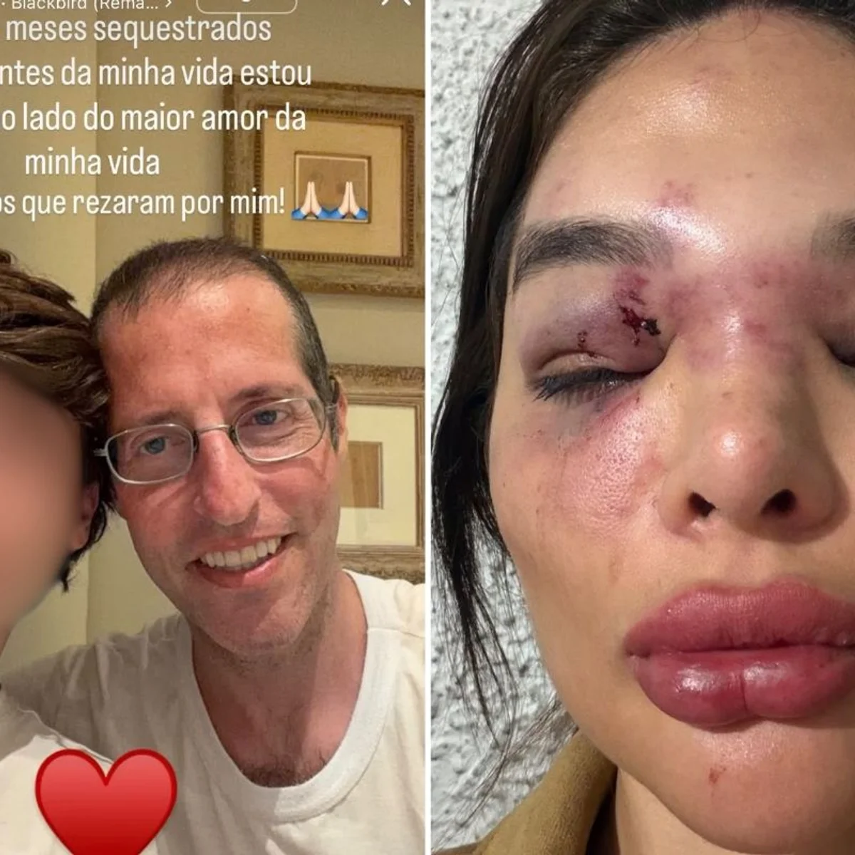 Ivo Kos usou arma de choque e taco de baisebol para agredir esposa, diz MP