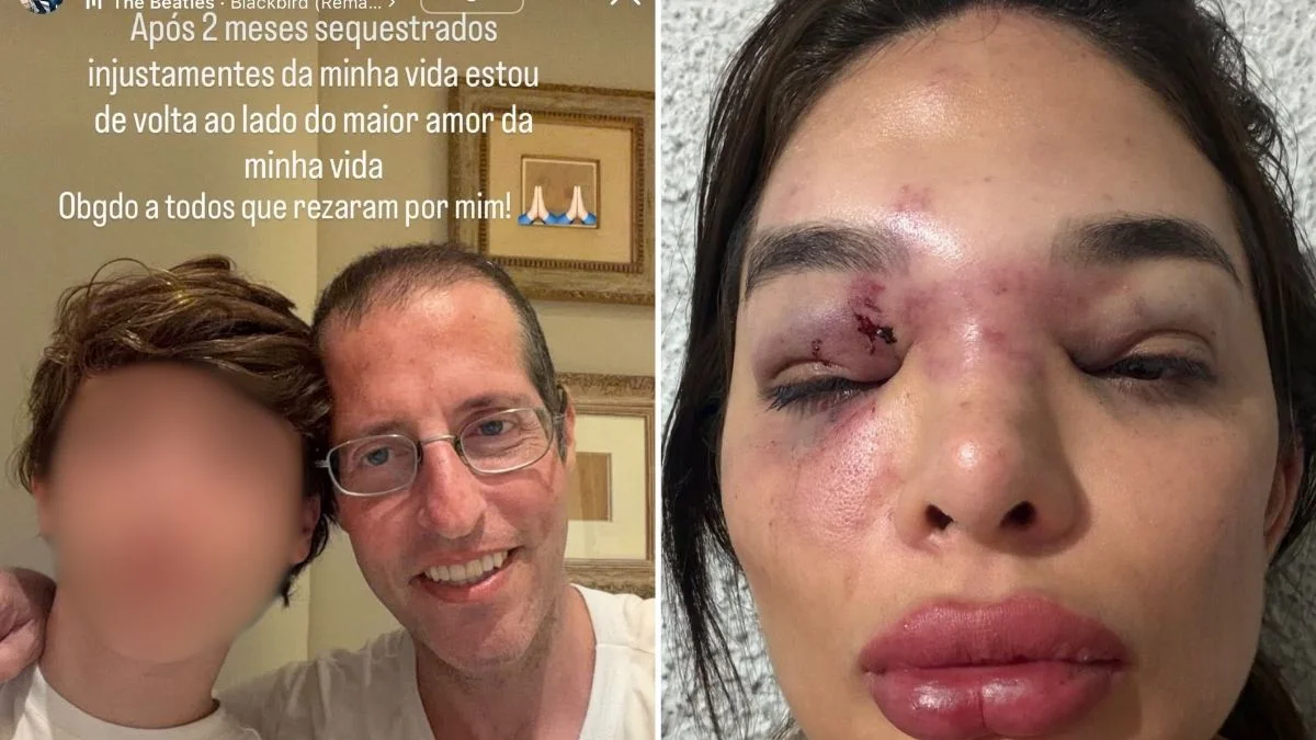 Ivo Kos usou arma de choque e taco de baisebol para agredir esposa, diz MP