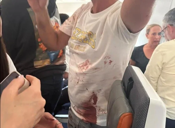 Emirados Árabes iniciam investigação sobre ataque em voo da Flydubai - destaque galeria