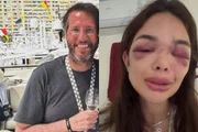 Ivo Kos usou arma de choque e taco de baisebol para agredir esposa, diz MP